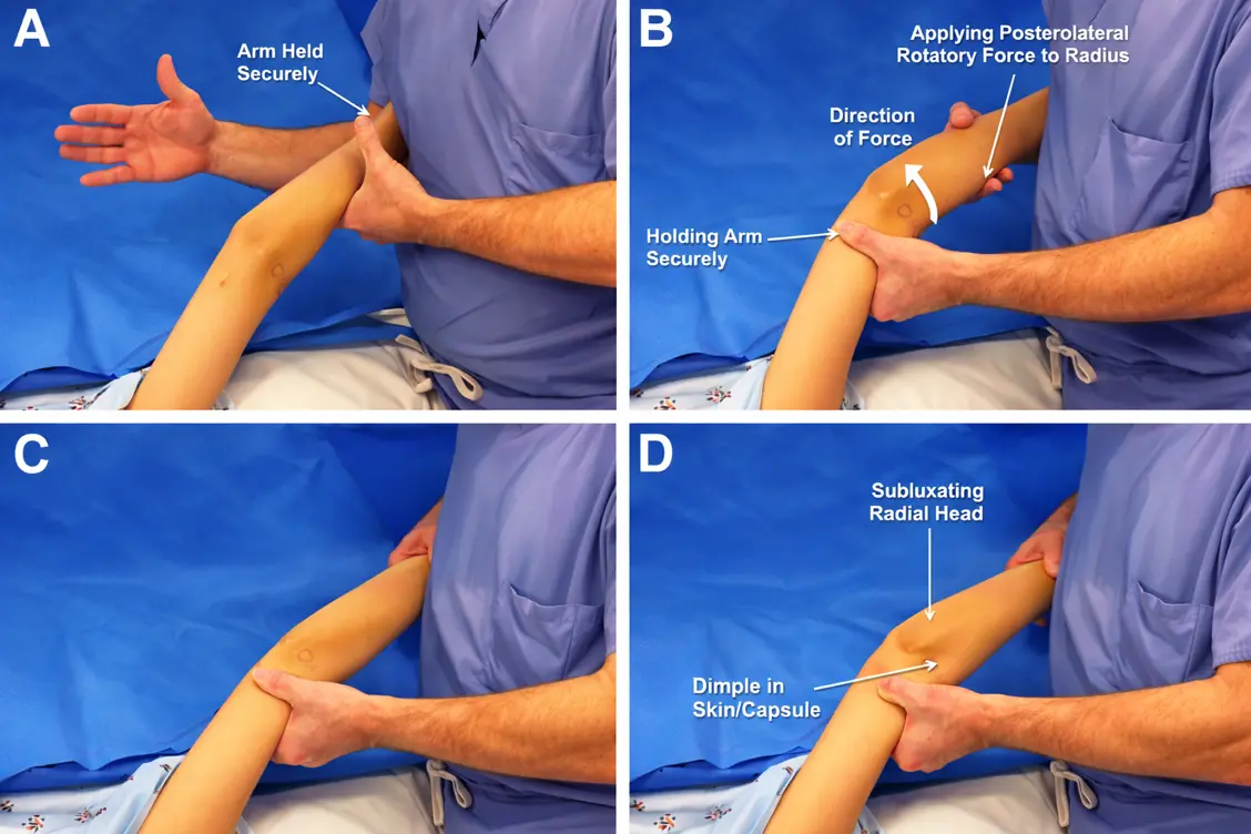 Posterolateral Apprehension Test Orthopedic Special Test